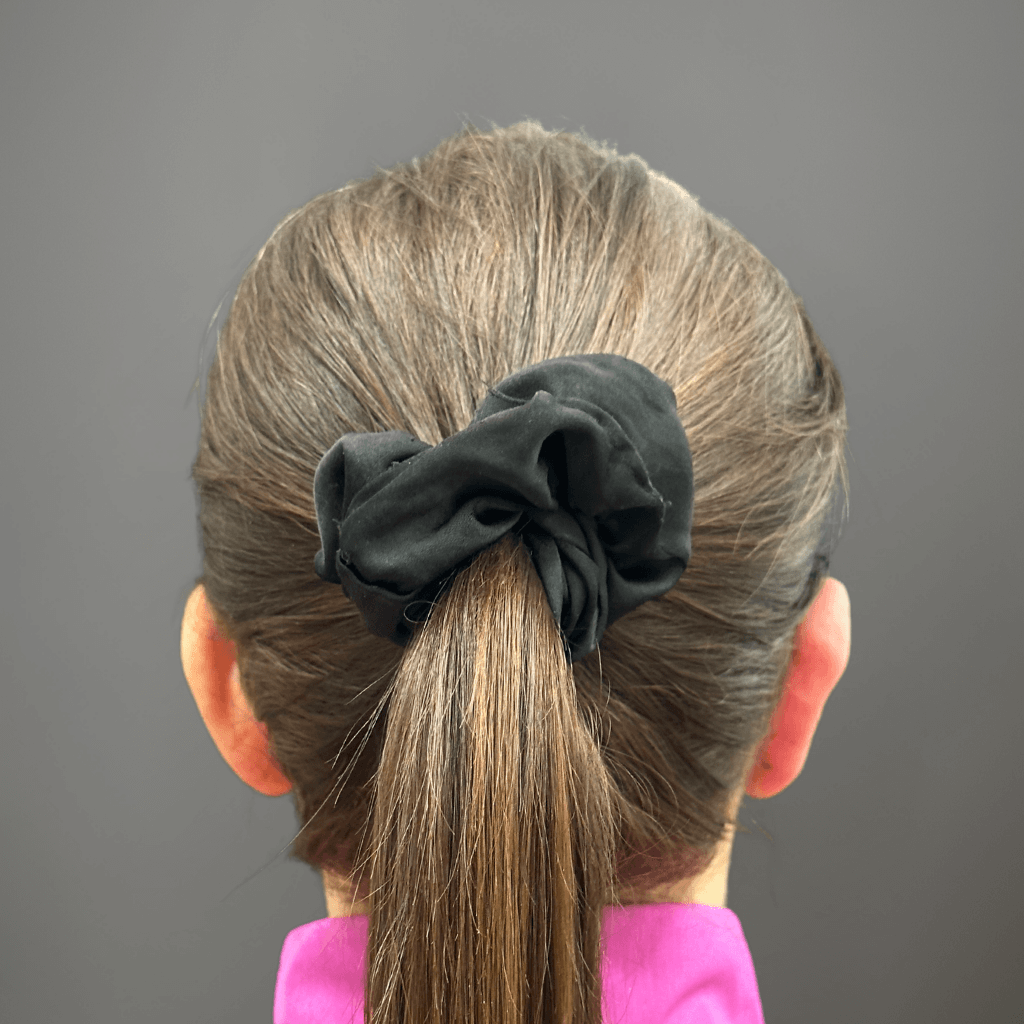 Заден изглед на ушите след едностранна отопластика, с подобрена симетрия и по-естествено разположение на ушната мида.