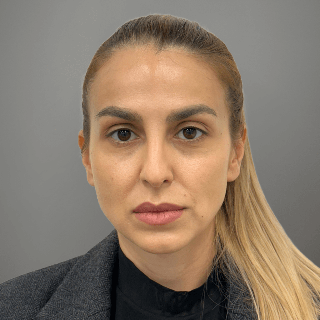 Фронтална снимка на пациент преди ринопластика в клиника Aesthetico