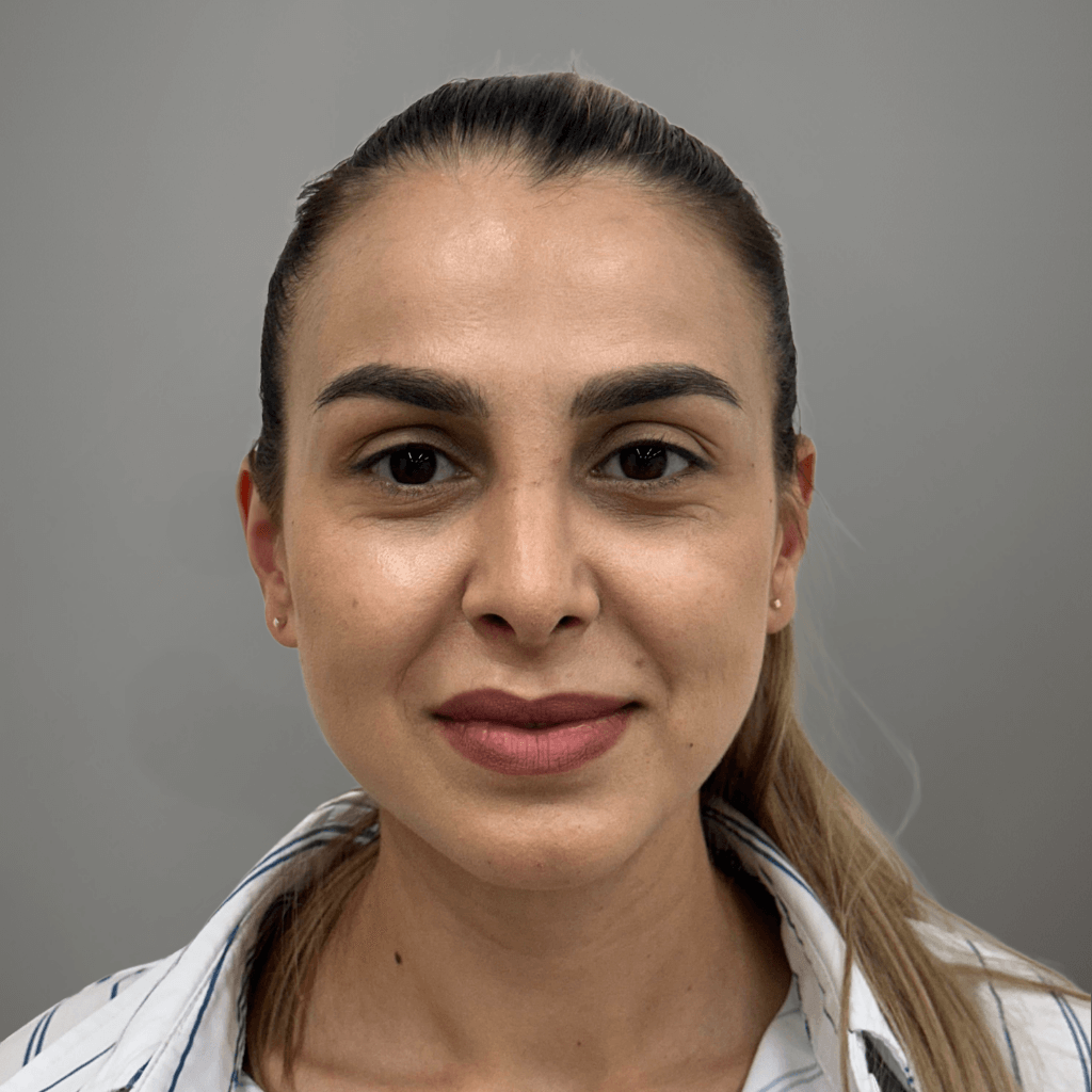 Фронтална снимка на пациент след ринопластика, демонстрираща по-хармоничен и балансиран вид на носа, извършена в клиника Aesthetico