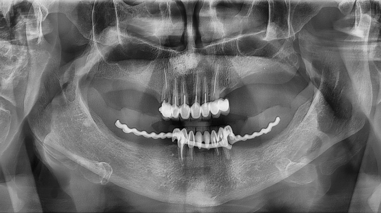 панорамна снимка на пациент