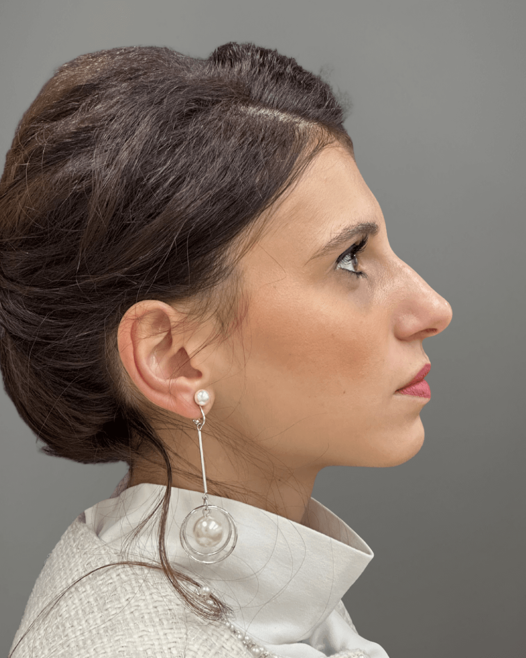 Десен профил преди ринопластика