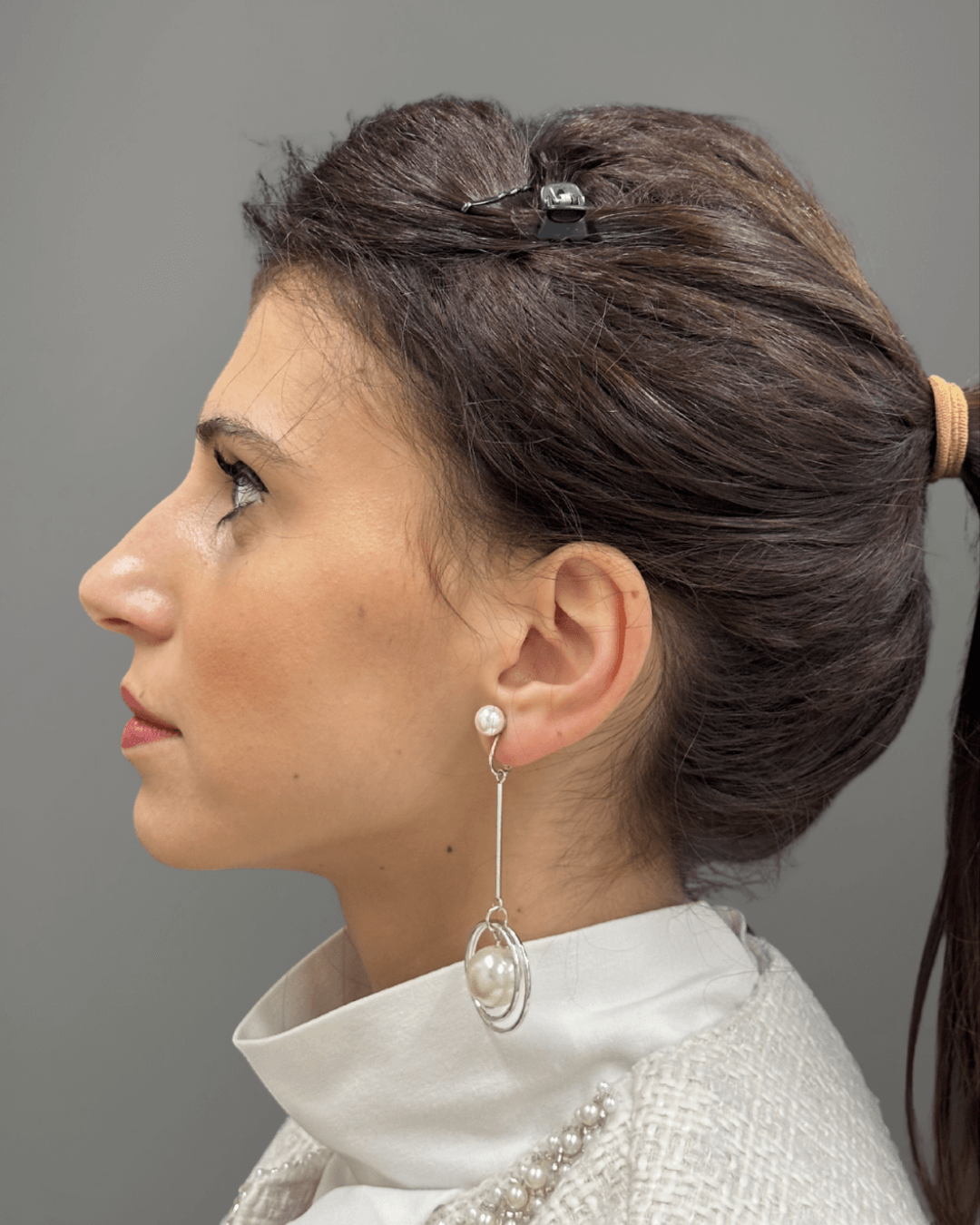 Ляв профил преди ринопластика – предоперативен изглед на носа